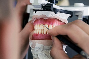 Dentures are made in a unique multi-step process