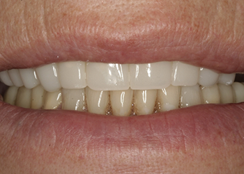 Healthy white smile