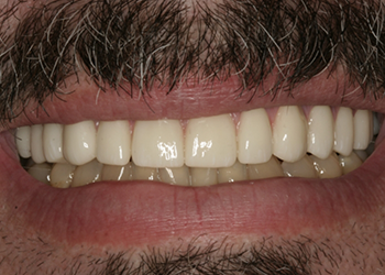 Healthy white smile