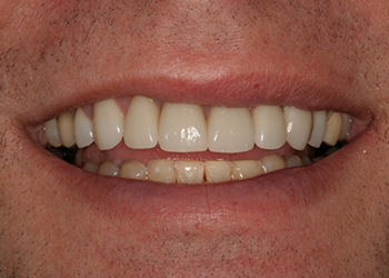 Healthy white smile