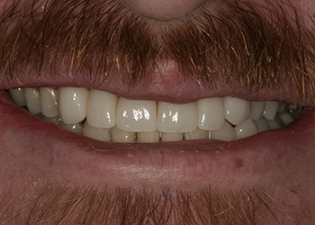 Healthy white smile