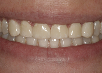 Healthy white smile