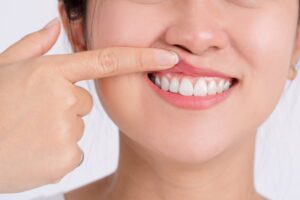 Woman revealing gums.