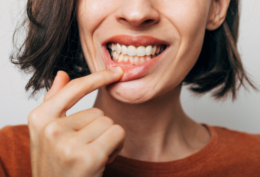 Woman pulling lip down to show gums